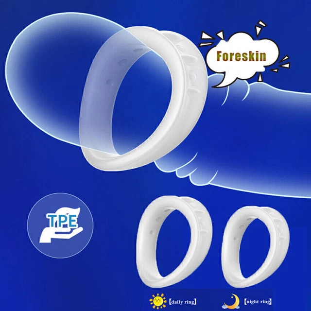 FORESKIN PHIMOSIS CURING GLANS CORRECTION COCK PENIS RING SEX