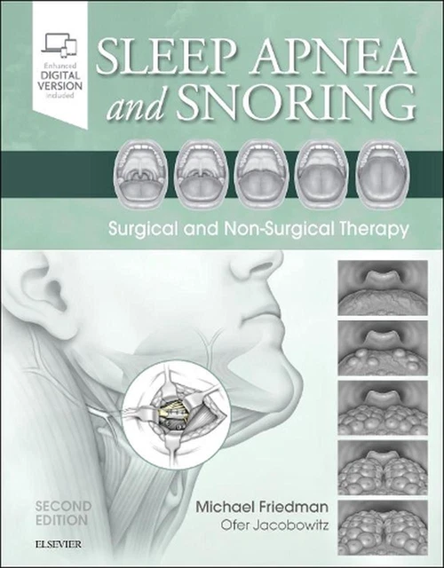 SLEEP APNEA AND Snoring Surgical and NonSurgical Therapy by Michael