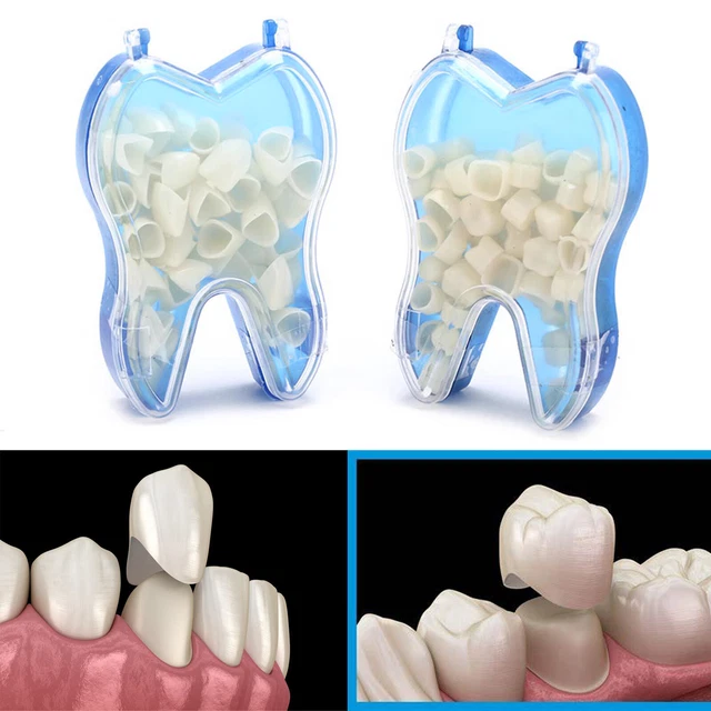 Dental Temporary Crowns – 1 Box Posteriors & Anterior Teeth, Porcelain-Look Crowns For Dentists
