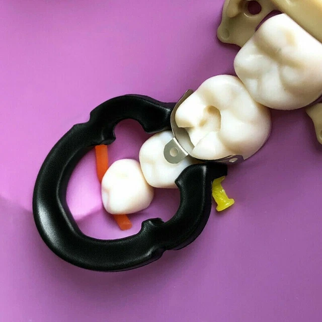 Dental Sectional Matrix Contoured Matrice Bands Fit Triodent Resin Clip Ring