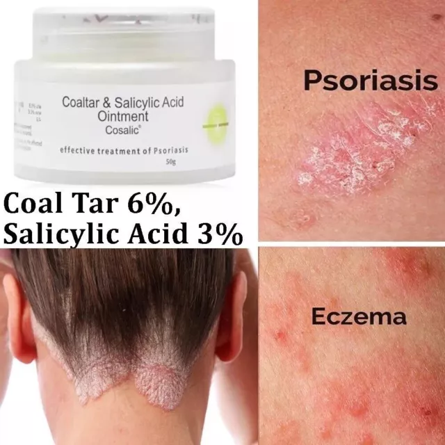 Coal Tar & Salicylic Acid Topical Ointment for Psoriasis (50g) Effective Formula