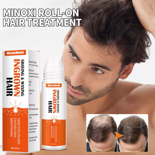 1/2/3pcs Minoxi Roll-on Hair Treatment, 2023 New Hair Growth Se ❀