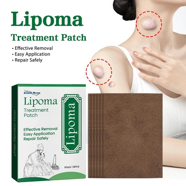 Parche de eliminación de lipoma antihinchazón, desintoxicación de drenaje linfático 2023 A2B1