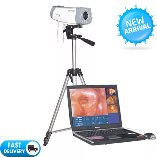 Portable Digital Electronic Colposcope 800000 Pixels Version Video with Tripod