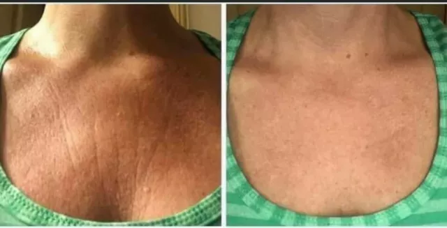 NuSkin AgeLoc DERMATIC EFFECTS aka Honey and Hibiscus Firming cream