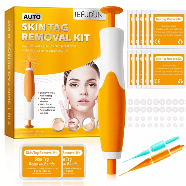 Auto Micro Skin Tag Remover Device Kit Safe Painless Removal 2-8 mm Band  Tool