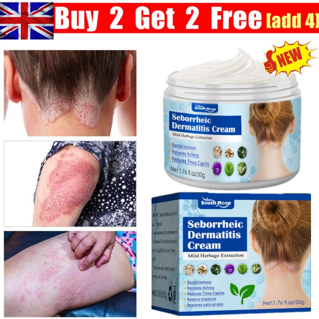 SKIN PSORIASIS CREAM Dermatitis Eczematoid Eczema Ointment Scalp