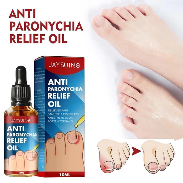Aceite de uñas de los pies reparación de uñas alivio dolor nutrición anti parónico ◑