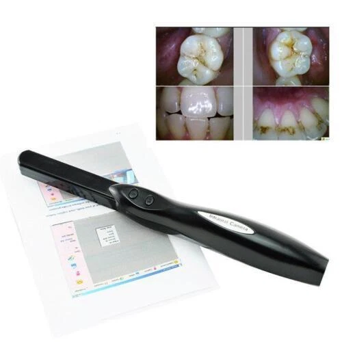High-Resolution Dental Camera with 6 LEDs - Ideal for Dentists and Patients