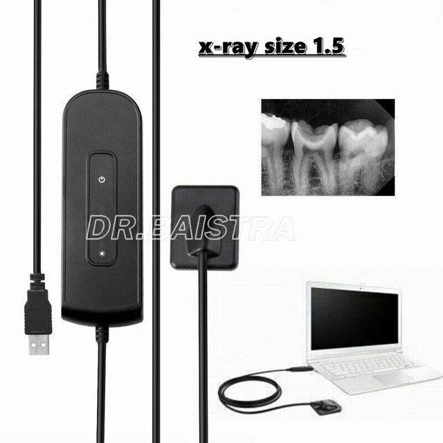 AZdent Dental Portable Xray Unit Digital Imaging High Frequency X-Ray Sensor 1.5