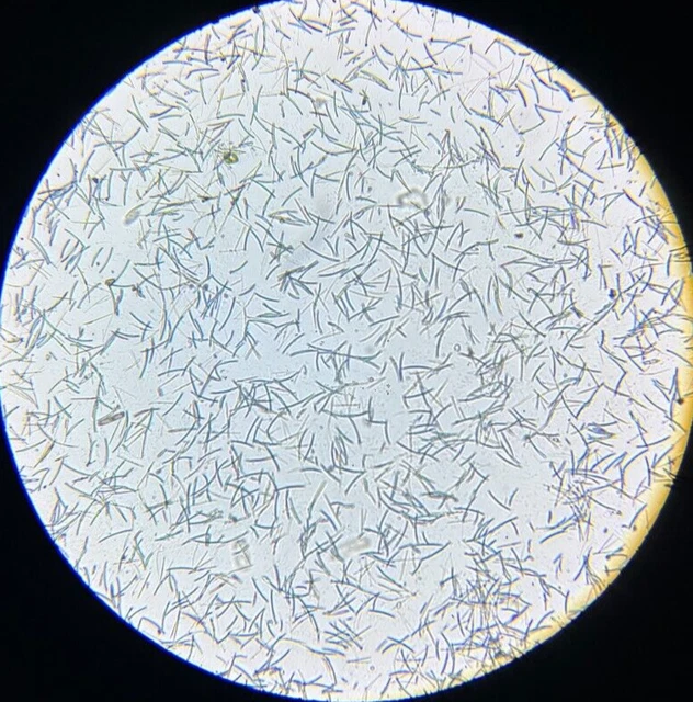 19th c J.D. Moller Microscope Slide Diatom Holstein Germany Ceratoneis Lunaris