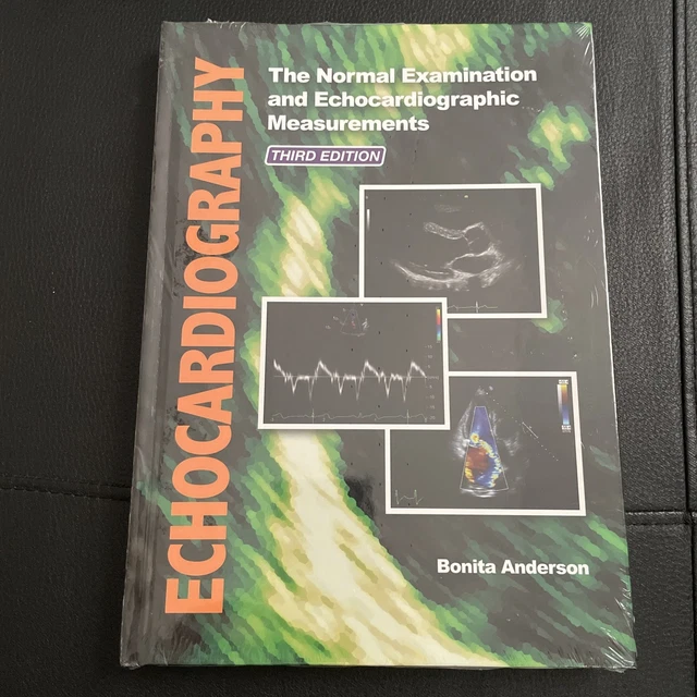 ECHOCARDIOGRAPHY: THE NORMAL Examination and Echocardiographic ...