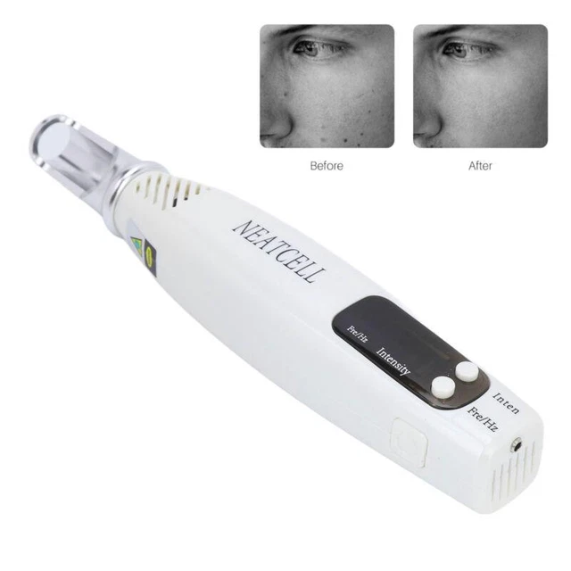 Portable Tattoo Removal Pen Dark Spot Mole Blue Light Therapy Device