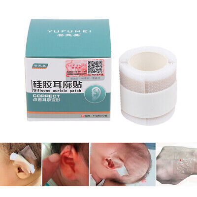Newborn Baby Ear Patch Stickers Ear Aesthetic Correctors Kids Protruding 4*5-AZ