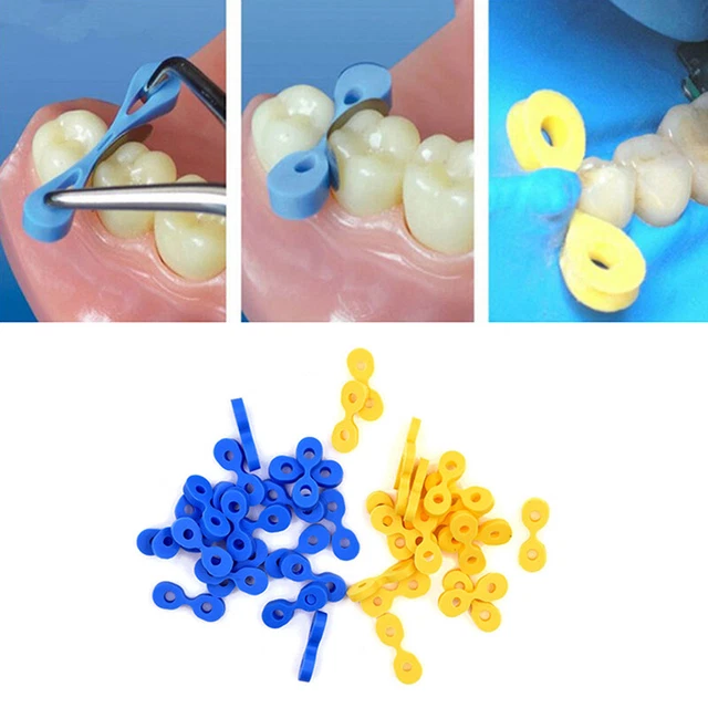 40pcs/box Dental Elastic Fixing Wedges Matrix Matrices Rubber Dam Materia F3
