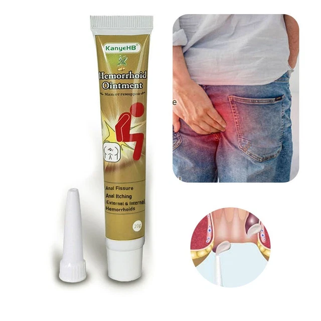 Emorroidi Interne Esterne Allevia il dolore anale Crema per le emorroidi