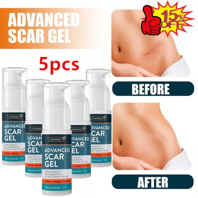 5X ScarAway Advanced Narbengel 30ML