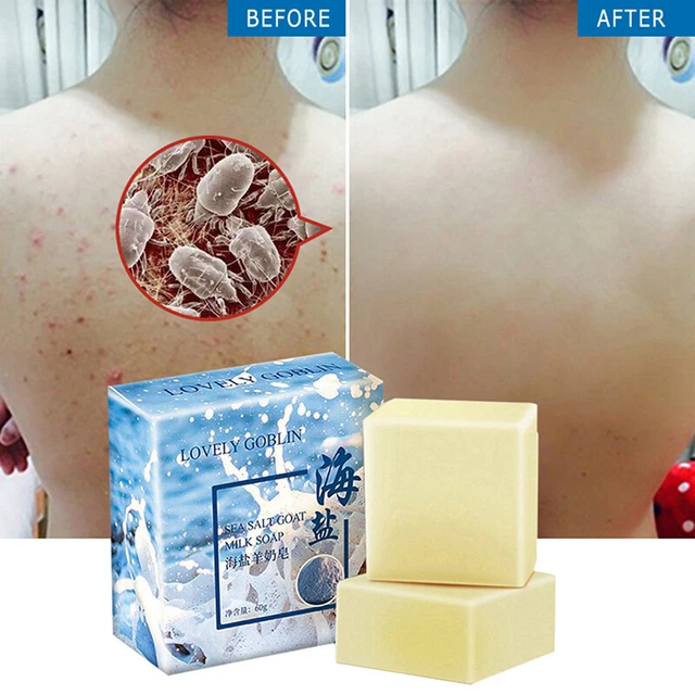Sea Salt Soap Facial Cleaner Pimple Acne Remover Opens Pores Goat Milk 60g ba