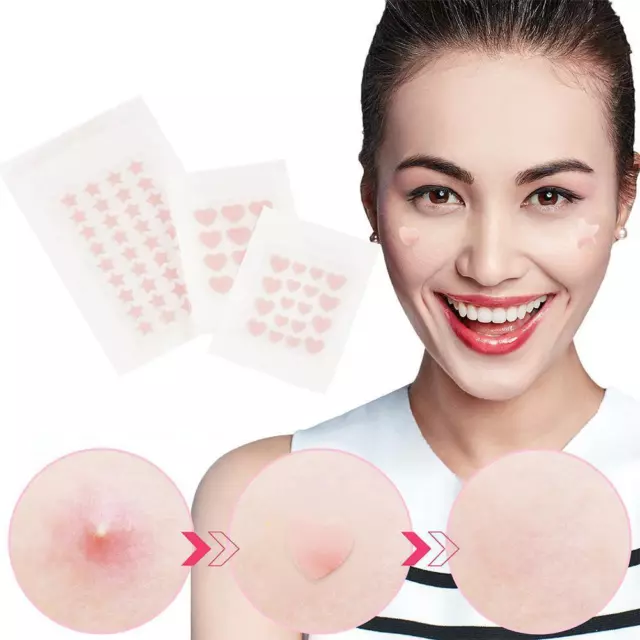 121836x Cute Acne Pimple Patch Stickers Absorbs Fluids Covers Blemishes Hot U1