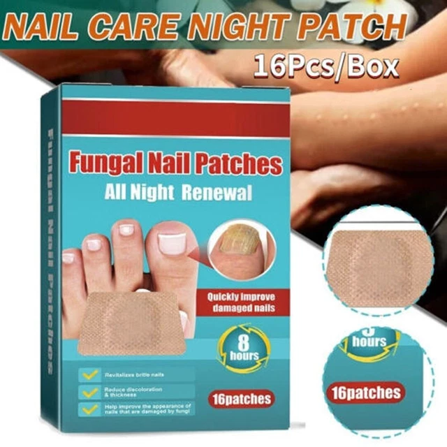 PEDICURE TOOLS NAIL Treatment Paronychia Treatment Onychomycosis Repair