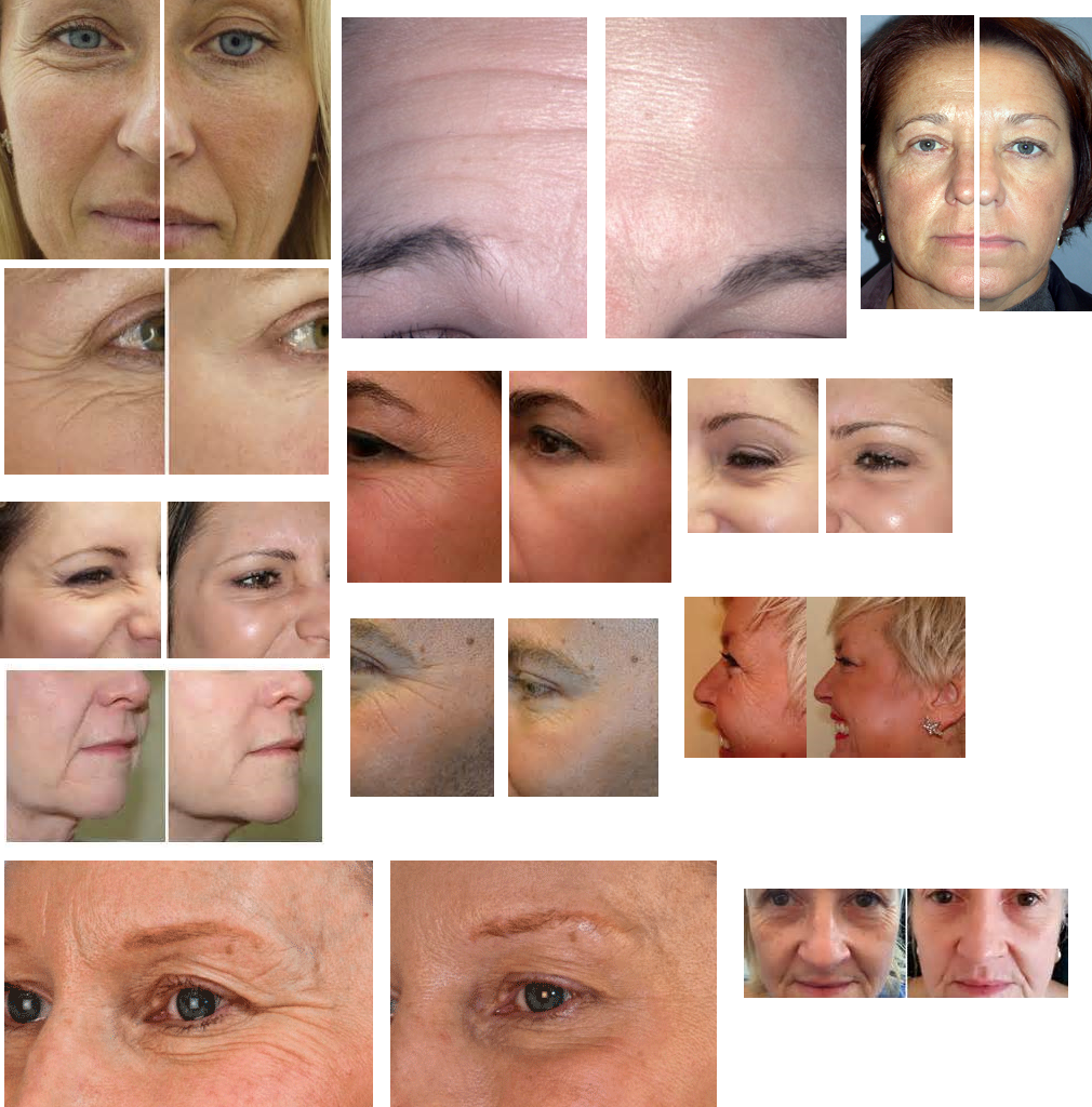 lifecell neck firming serum