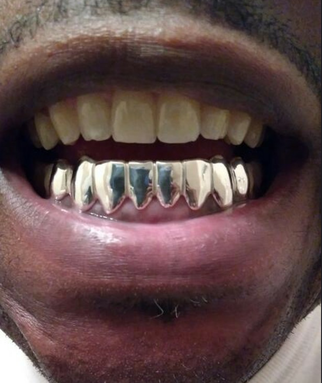 all-silver-teeth