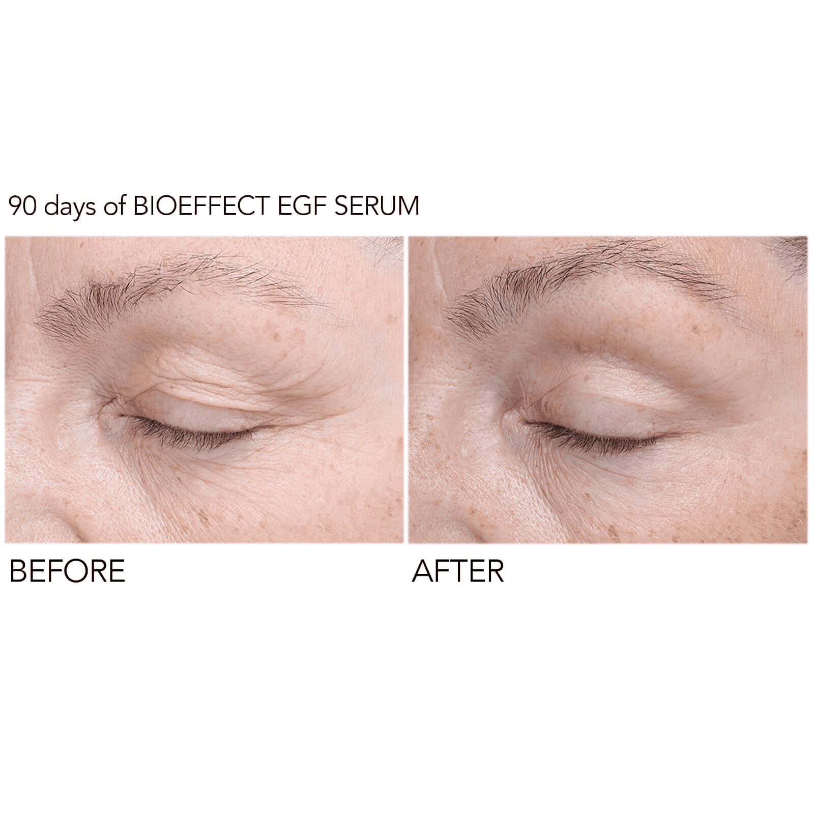 bioeffect egf eye serum 6ml