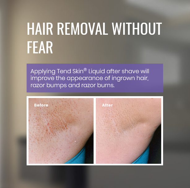 Tend Skin 16 Oz Ingrown Hair Solution For Use After Shaving Waxing