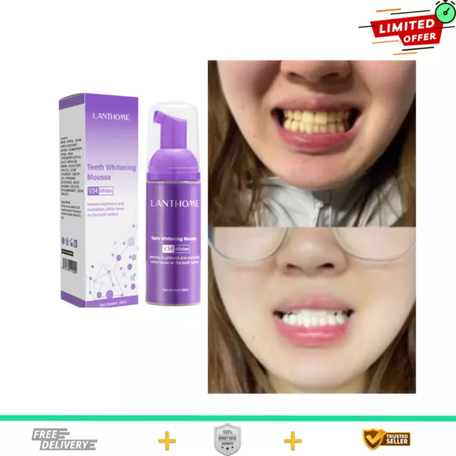 50ml  Guaranteed Teeth Whitening Toothpaste Mousse V34 Oral Care Stain Remover