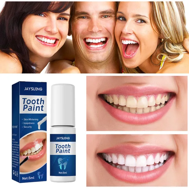 Blanqueamiento dental limpio color gel dientes noble eliminación higiene oral 🙂