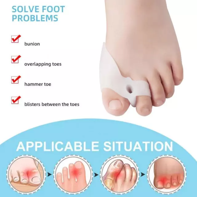 Neue Heiße 2 stücke Toe Separator Toe Corrector Zehen Hülse Zehen Splitter/