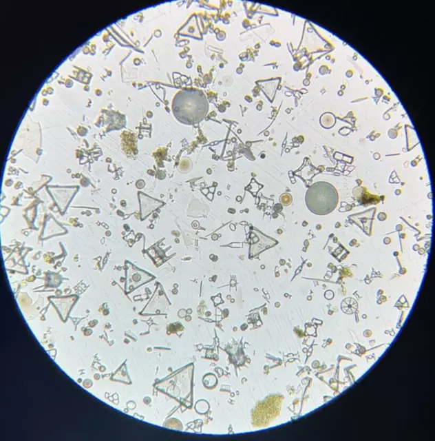 J.D. Moller Microscope Slide Diatom Fossil Cementstone Island of Mors Finland