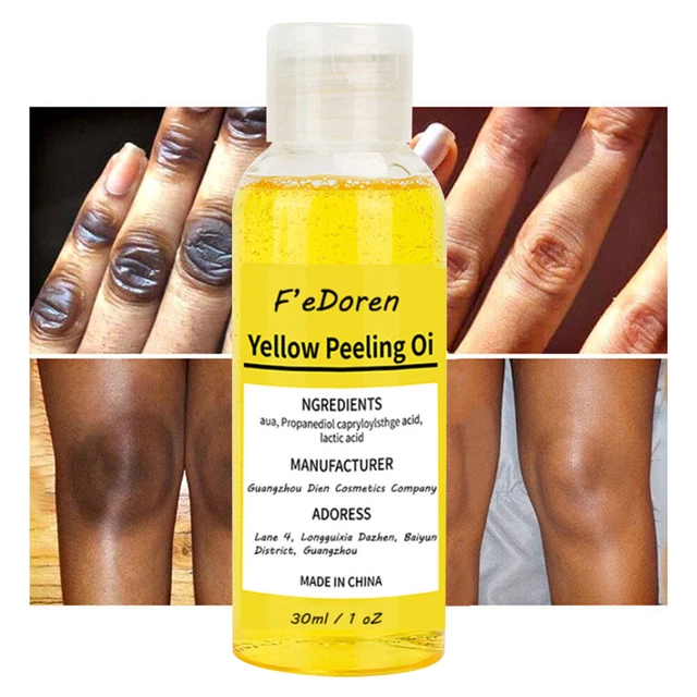 YELLOW PEELING OIL Lighten Dark Spots Acne Melanin Skin Bleaching