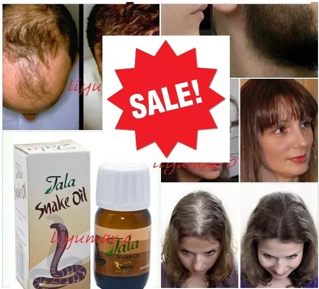 Snake Oil Hair Serum Tala 20 ml  Hair Loss Growing Treatment Growth promoter