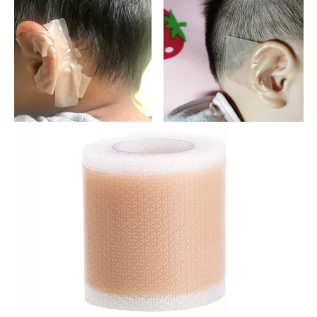 Ear Aesthetic Correctors Newborn Baby Ear Patch Stickers Infant Protruding