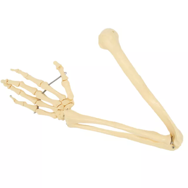 Arm-Knochen-Modell Knochen-Modell Hand-Arm-Knochen-Modell Professionelle