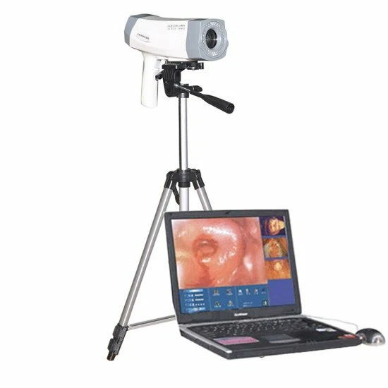 Carejoy Digital Video Electronic Colposcope 480,000 Pix Camera Software+Tripod