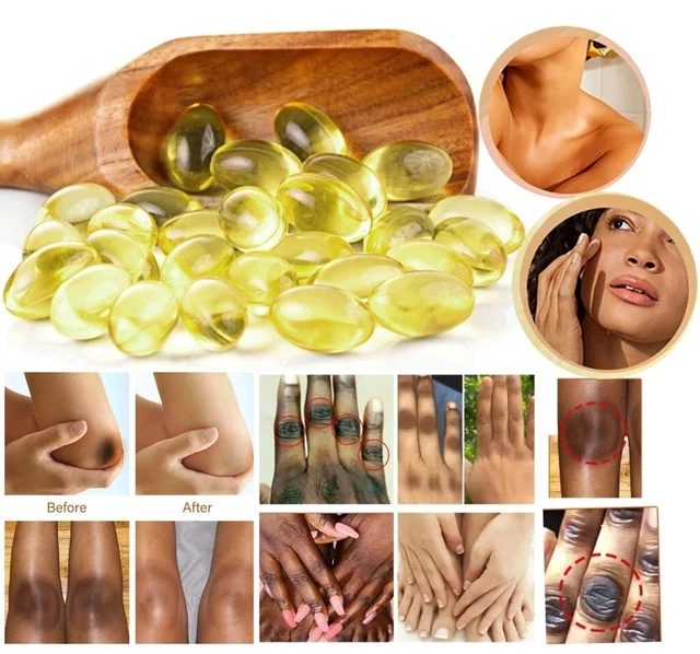 Gélules Glutathion Collagène - Blanchissant Et éclaircissant - 120 Gélules - 100% Naturel
