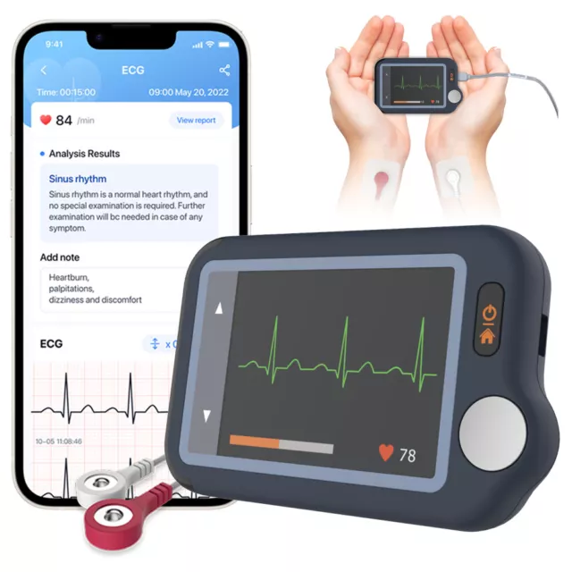 AI Personal ECG EKG Monitor Bluetooth Heart Monitor AI-ECG Analysis via Free App