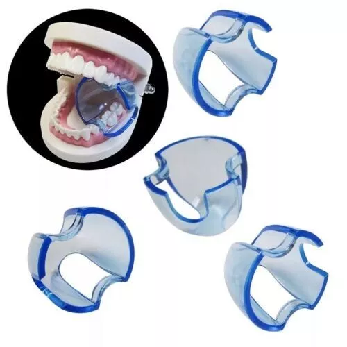 5Pcs Dental Mouth Gag Opener Posterior Lip Retractor Cheek Expander Bite Props