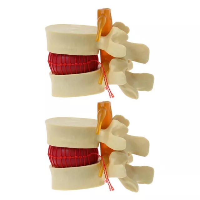 2X Lenden Wirbel Modell Anatomische Wirbel Säule Lenden Wirbel Scheiben Vor9572