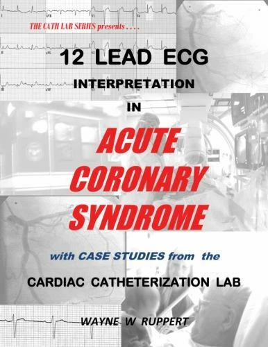 12 LEAD ECG Interpretation in Acute Coronary Syndrome with Case Studies ...