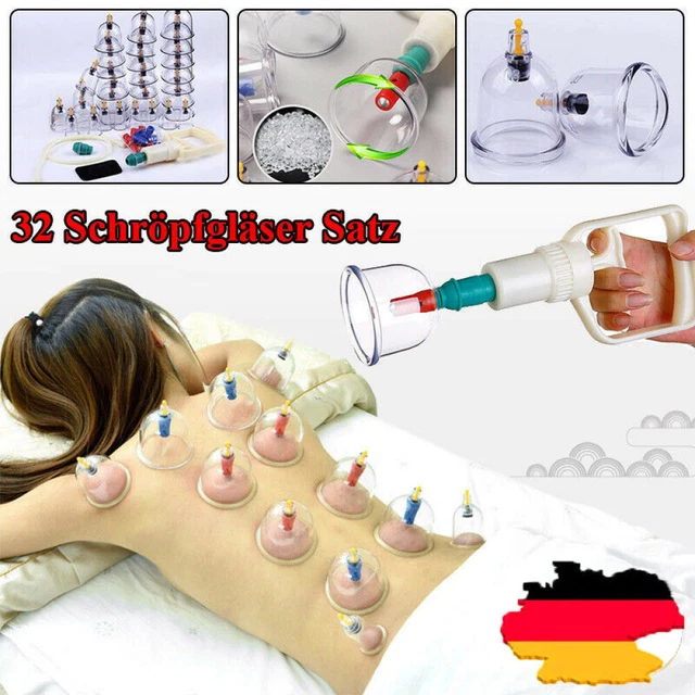 32 Stk Profi Schröpfglas-Set Massage Medizinisches Schröpfset Vakuum Cupping-Set 2