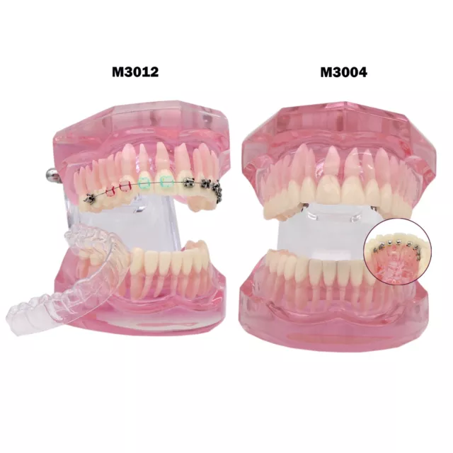 Dental Ortho Teeth Model With Metal Ceramic Brackets Lingual Braces Tube Demo