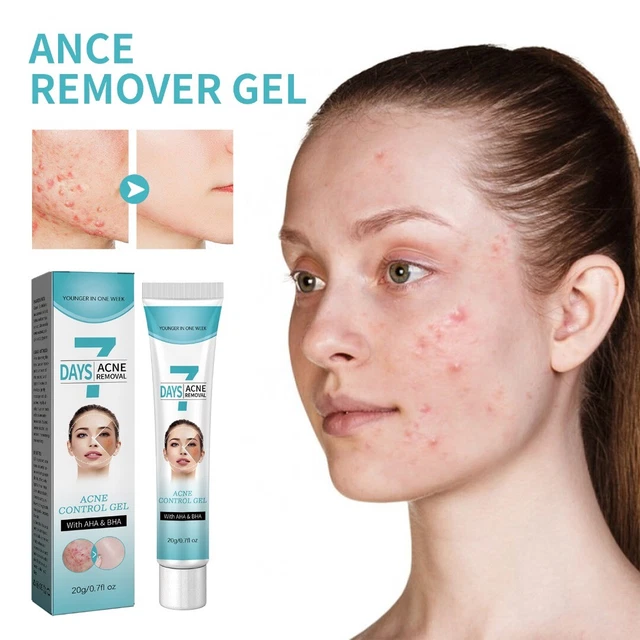 Gel para eliminar el acné crema tratamiento de eliminación de marcas de granos faciales hierba cuidado calmante