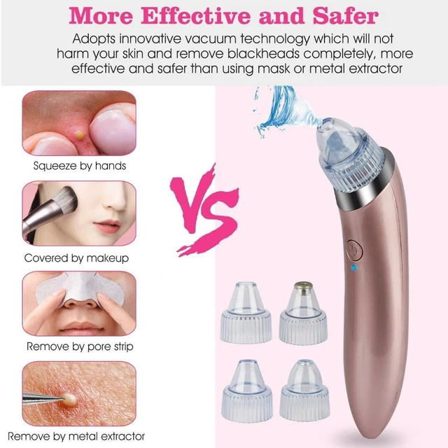 Limpiador eléctrico de poros para el cuidado de la piel facial removedor aspirador para el acné