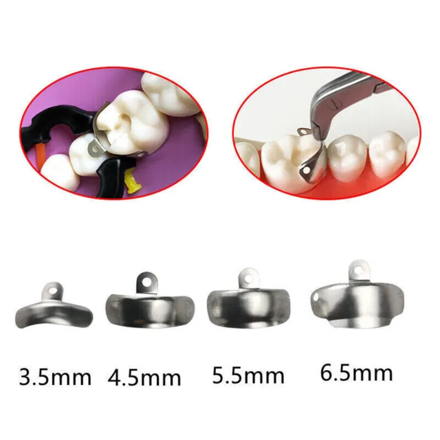 Dental Metal Matrix Bands Refill Tall Molar Sectional Contoured Matrices Wedges