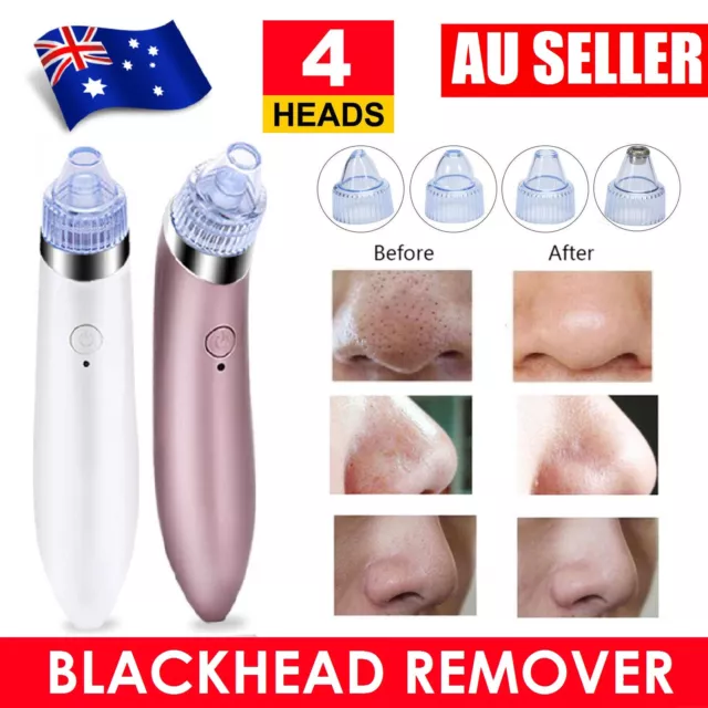 Blackhead Remover Vacuum Facial Skin Pore Acne Pimple Sucker Cleaner Machine Au