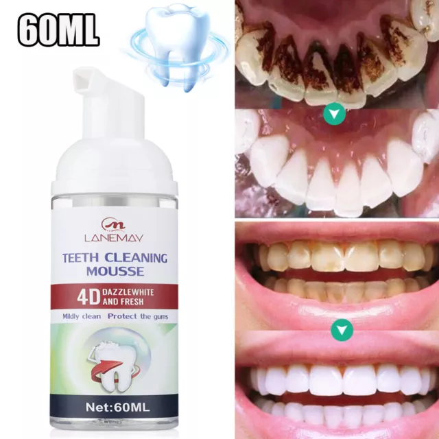 Pasta de dientes de espuma blanqueador de dientes bicarbonato de sodio pasta de dientes espuma eliminación de manchas