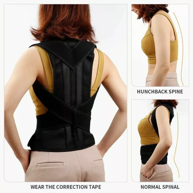 FAJA CORRECTORA DE Postura Fajas Ortopedicas Para Hombres Mujer La Espalda  Talla $19.99 - PicClick